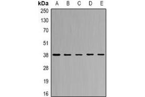 Western blot analysis of CapG expression in SW620 (A), THP1 (B), mouse lung (C), mouse spleen (D), rat heart (E) whole cell lysates. (CAPG antibody)