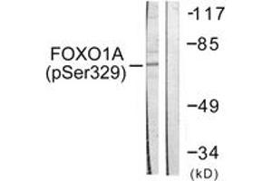 Western blot analysis of extracts from HeLa cells treated with Serum 20% 15', using FOXO1A (Phospho-Ser329) Antibody. (FOXO1 antibody  (pSer329))