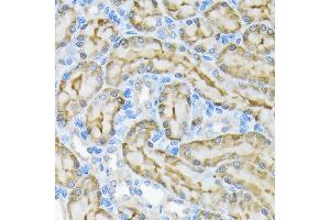 Immunohistochemistry of paraffin-embedded rat kidney using Glycerol kinase (GK) Rabbit mAb (ABIN7267457) at dilution of 1:100 (40x lens). (Glycerol Kinase antibody)