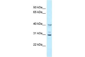 WB Suggested Anti-Oas1g Antibody Titration: 1. (OAS1G antibody  (N-Term))