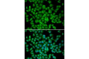 Immunofluorescence analysis of HeLa cells using CDKN2C antibody. (CDKN2C antibody)