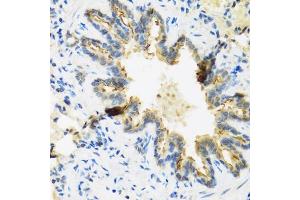 Immunohistochemistry of paraffin-embedded rat lung using DEFB4A antibody (ABIN3015538, ABIN3015539, ABIN3015540 and ABIN6218726) at dilution of 1:100 (40x lens). (DEFB4A antibody  (AA 1-64))