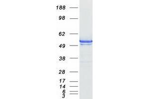 eEF1A1 Protein (Myc-DYKDDDDK Tag)