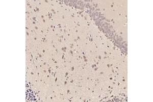 Immunohistochemistry analysis of paraffin-embedded rat striatum using,RMND5A (ABIN7075401) at dilution of 1: 3000