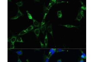 Immunofluorescence analysis of NIH-3T3 cells using BUB1B Polyclonal Antibody at dilution of 1:100. (BUB1B antibody)