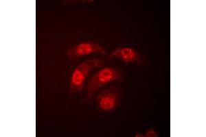 Immunofluorescent analysis of p38 staining in HeLa cells. (MAPK14 antibody  (Center))