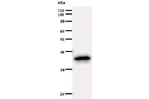Western Blotting (WB) image for anti-Sex Comb On Midleg-Like 2 (SCML2) antibody (ABIN933093)