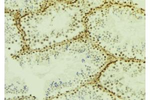 ABIN6277185 at 1/100 staining Mouse testis tissue by IHC-P.