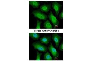 ICC/IF Image Immunofluorescence analysis of paraformaldehyde-fixed HeLa, using FACA, antibody at 1:200 dilution. (FANCA antibody  (N-Term))