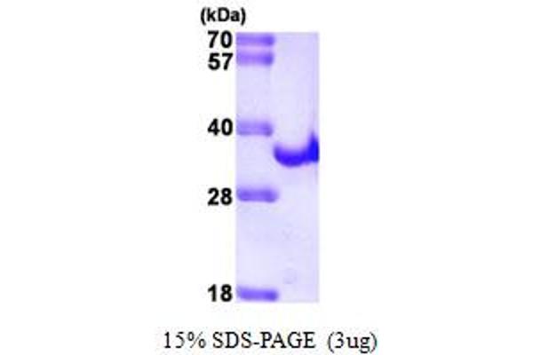 HCV NS3 Protein (AA 1225-1456) (His tag)