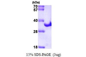 SDS-PAGE (SDS) image for Hepatitis C Virus NS3 (HCV NS3) (AA 1225-1456) protein (His tag) (ABIN667776) (HCV NS3 Protein (AA 1225-1456) (His tag))