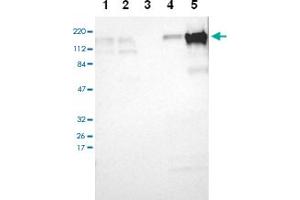 Western blot analysis of Lane 1: RT-4, Lane 2: U-251 MG, Lane 3: A-431, Lane 4: Liver, Lane 5: Tonsil with TJP2 polyclonal antibody at 1:100-1:250 dilution. (TJP2 antibody)