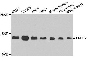 Western blot analysis of extract of various cells, using FKBP2 antibody. (FKBP2 antibody)