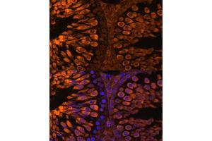 Immunofluorescence analysis of rat testis using LDHC Polyclonal Antibody (ABIN7268172) at dilution of 1:100 (40x lens). (Lactate Dehydrogenase C antibody  (AA 150-250))