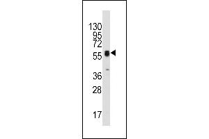 Western blot analysis of anti-ECGF1(Center) Pab (ABIN391460 and ABIN2841435) in HepG2 cell line lysates (35 μg/lane). (Thymidine Phosphorylase antibody  (AA 318-345))