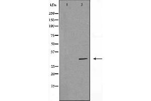 Western blot analysis of Hela whole cell lysates, using PHB Antibody. (Prohibitin antibody  (Internal Region))