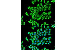 Immunofluorescence analysis of A549 cell using LCN2 antibody. (Lipocalin 2 antibody)