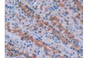 Immunohistochemistry (IHC) image for anti-Interleukin 6 (IL6) (AA 21-211) antibody (ABIN7427093)
