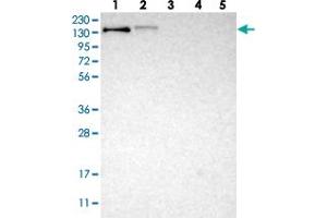 Western blot analysis of Lane 1: RT-4, Lane 2: U-251 MG, Lane 3: Human Plasma, Lane 4: Liver, Lane 5: Tonsil with LRIG2 polyclonal antibody . (LRIG2 antibody)