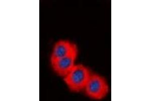 Immunofluorescent analysis of TSC2 staining in HepG2 cells. (Tuberin antibody)