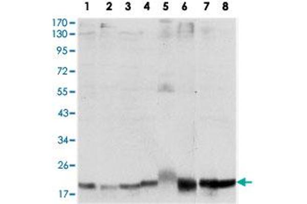 SKP1 anticorps
