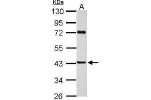 WB Image Sample (30 ug of whole cell lysate) A: JC 10% SDS PAGE antibody diluted at 1:1000 (SERPINB2 antibody  (Center))