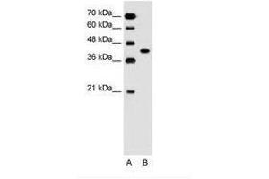 Image no. 1 for anti-Solute Carrier Family 35, Member B1 (SLC35B1) (AA 288-337) antibody (ABIN205013) (SLC35B1 antibody  (AA 288-337))