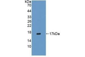 Detection of Recombinant IFNg, Porcine using Polyclonal Antibody to Interferon Gamma (IFNg) (Interferon gamma antibody  (AA 21-166))