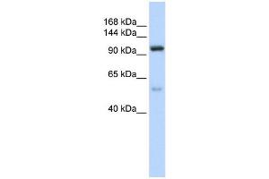 NOL6 antibody used at 1 ug/ml to detect target protein. (Nucleolar Protein 6 antibody)