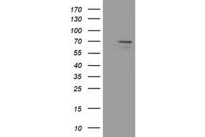 HEK293T cells were transfected with the pCMV6-ENTRY control (Left lane) or pCMV6-ENTRY MPP3 (Right lane) cDNA for 48 hrs and lysed. (MPP3 antibody)