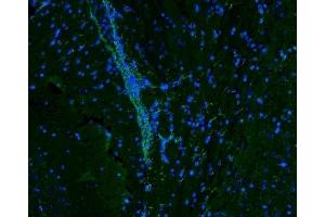 IF analysis of Vimentin using anti-Vimentin antibody (ABIN3042344).