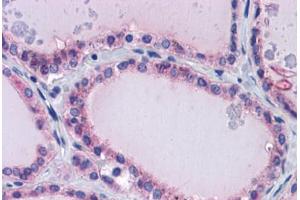 Human Thyroid: Formalin-Fixed, Paraffin-Embedded (FFPE) (PAX8 antibody  (AA 215-264))