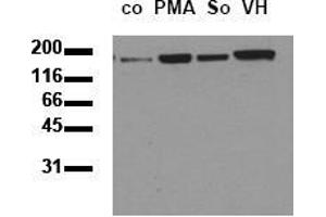 Western Blotting (WB) image for anti-Epidermal Growth Factor Receptor (EGFR) (pThr693) antibody (ABIN126758) (EGFR antibody  (pThr693))