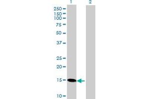 Western Blot analysis of RCAN1 expression in transfected 293T cell line by RCAN1 MaxPab polyclonal antibody. (RCAN1 antibody  (AA 1-117))
