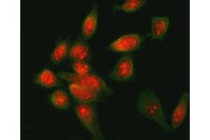 IF analysis of ATF6 using anti-ATF6 antibody (ABIN7602466) and anti-Beta Tubulin antibody (ABIN7602743).