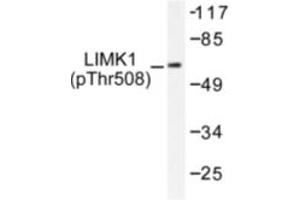 Image no. 1 for anti-LIM Domain Kinase 1 (LIMK1) (pThr508) antibody (ABIN318062) (LIM Domain Kinase 1 antibody  (pThr508))