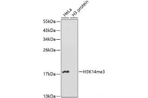 Western blot analysis of extracts of various cell lines using TriMethyl-Histone H3-K14 Polyclonal Antibody. (Histone 3 antibody  (3meLys14))