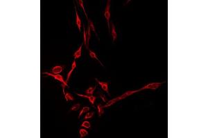 Immunofluorescence (fixed cells) (IF/ICC) image for anti-Chondroitin Sulfate Synthase 1 (CHSY1) (Internal Region) antibody (ABIN6259032)