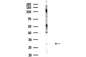 anti-NK2 Homeobox 6 (NKX2-6) (Internal Region) antibody