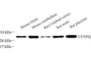 Western blot analysis of CENPQ (ABIN7073428) at dilution of 1: 1000