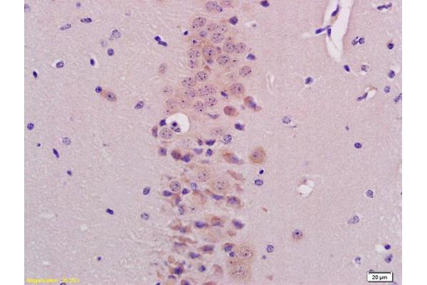 BHLHB9 antibody  (AA 451-547)