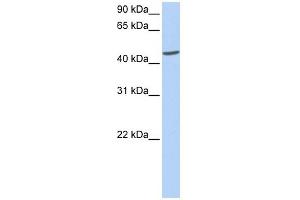 ICA1 antibody used at 1 ug/ml to detect target protein. (ICA1 antibody  (C-Term))