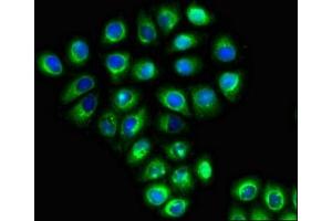 Immunofluorescent analysis of A549 cells using ABIN7169952 at dilution of 1:100 and Alexa Fluor 488-congugated AffiniPure Goat Anti-Rabbit IgG(H+L) (SLC6A13 antibody  (AA 1-40))