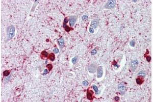 Brain, cortex, Human: Formalin-Fixed, Paraffin-Embedded (FFPE) (CRYAB antibody)