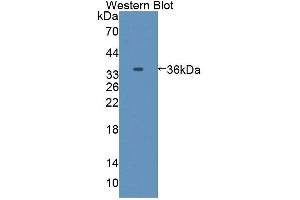 Detection of Recombinant C8a, Mouse using Polyclonal Antibody to Complement Component 8a (C8a) (C8A antibody  (AA 21-300))