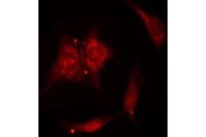 ABIN6277520 staining  NIH-3T3 cells by IF/ICC. (PTGES3 antibody  (C-Term))