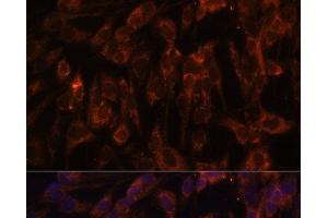 Immunofluorescence analysis of C6 cells using TLR3 Polyclonal Antibody at dilution of 1:100. (TLR3 antibody)