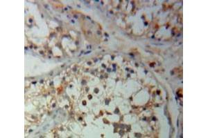 Used in DAB staining on fromalin fixed paraffin-embedded Testis tissue (Hexokinase 2 antibody  (AA 469-669))