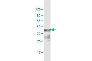 Western Blot detection against Immunogen (37. (SLC44A2 antibody  (AA 123-230))