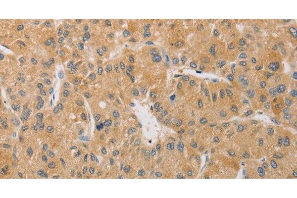 Arylsulfatase K antibody